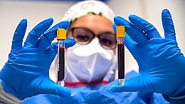 Coronavirus, al via in Sicilia test sierologici soltanto su alcune categorie: ecco quali