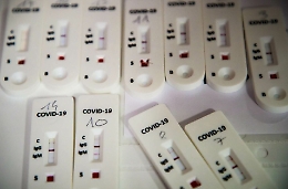 Coronavirus, in Sicilia oltre 200 laboratori privati pronti per i test sierologici