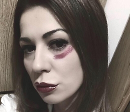 Matilde Siracusano: «Attacchi sessisti per me su Fb con commenti schifosi»