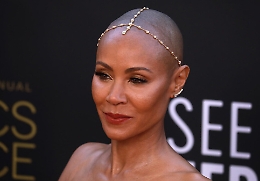 Malattia moglie Will Smith, cos'&egrave; l'alopecia e e da cosa &egrave; provocata