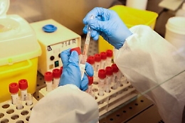 Covid, in aumento in Italia Rt e incidenza